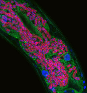 Microsporidia infecting C. elegans intestine