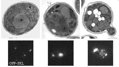 Peroxisome morphology on different growth media (Pichia pastoris)