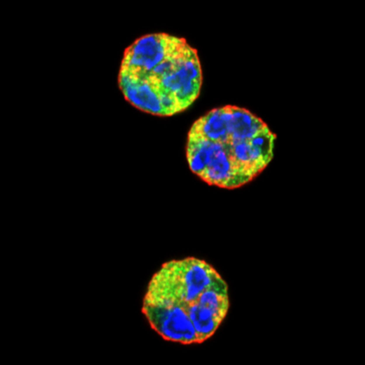 A microscopic image of three cells with green, blue, red, and yellow colors located close to each other.
