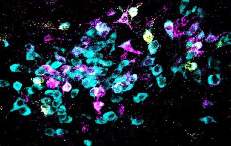 Microscopic image neurons